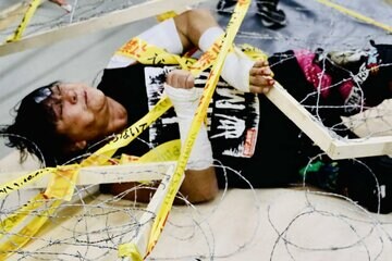 首を負傷した大仁田厚（大仁田屋提供）