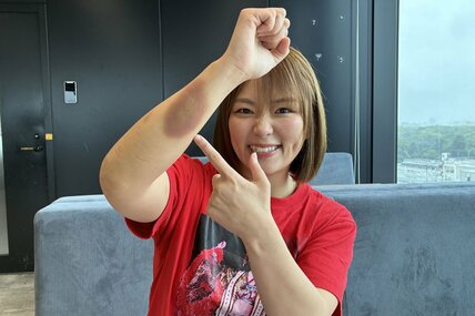 復帰戦でエルボーを放った際にできたアザを指さすＳａｒｅｅｅ