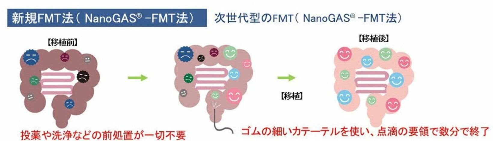 健康な人の腸内フローラを移植できる