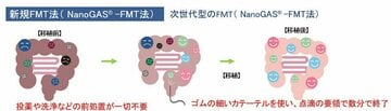 健康な人の腸内フローラを移植できる