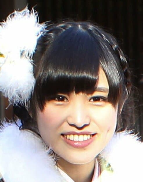 元乃木坂46・伊藤かりんが顎変型症の手術終了「わりと元気」 | 東スポWEB