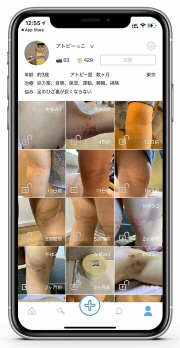  写真によって自身の治療経過が「見える化」される（東スポWeb）