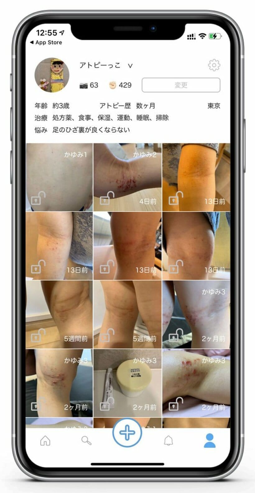  写真によって自身の治療経過が「見える化」される（東スポWeb）