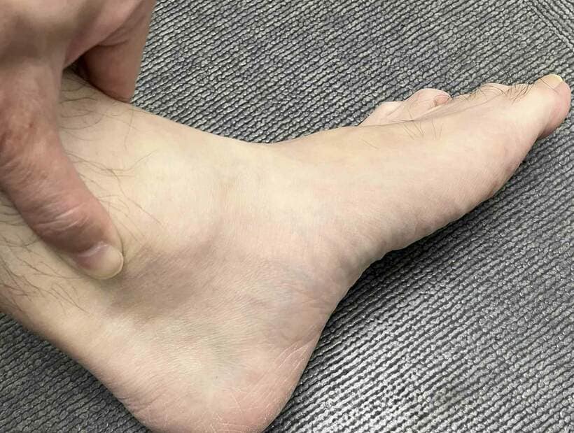 こむら返りは誰にでも起きる