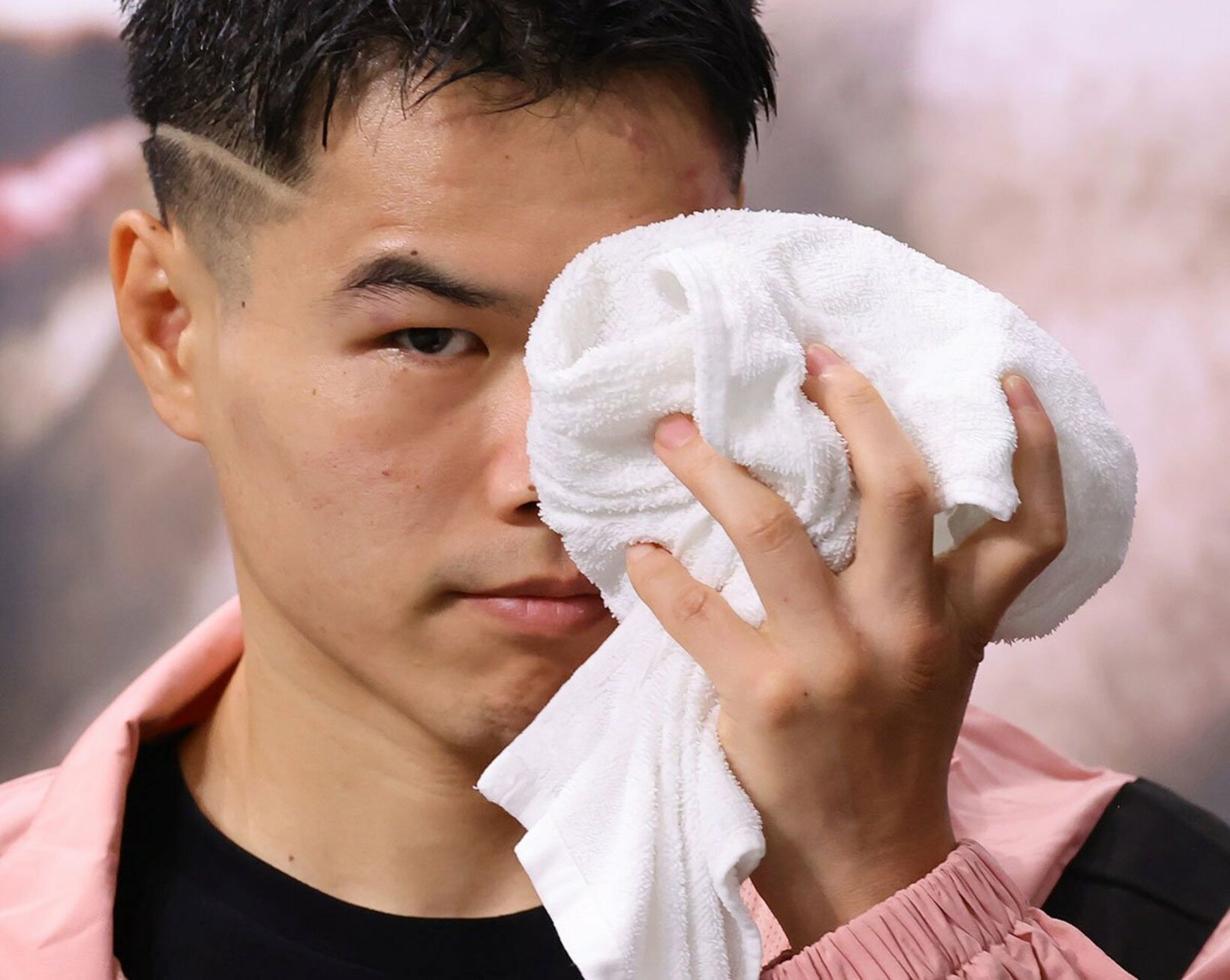 腫れた左目をアイシングする金芸俊