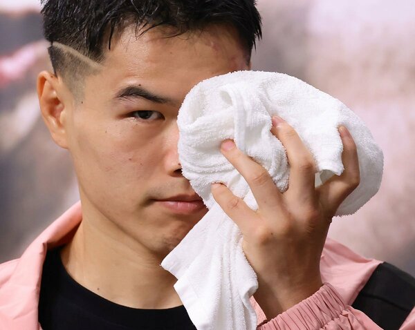 腫れた左目をアイシングする金芸俊