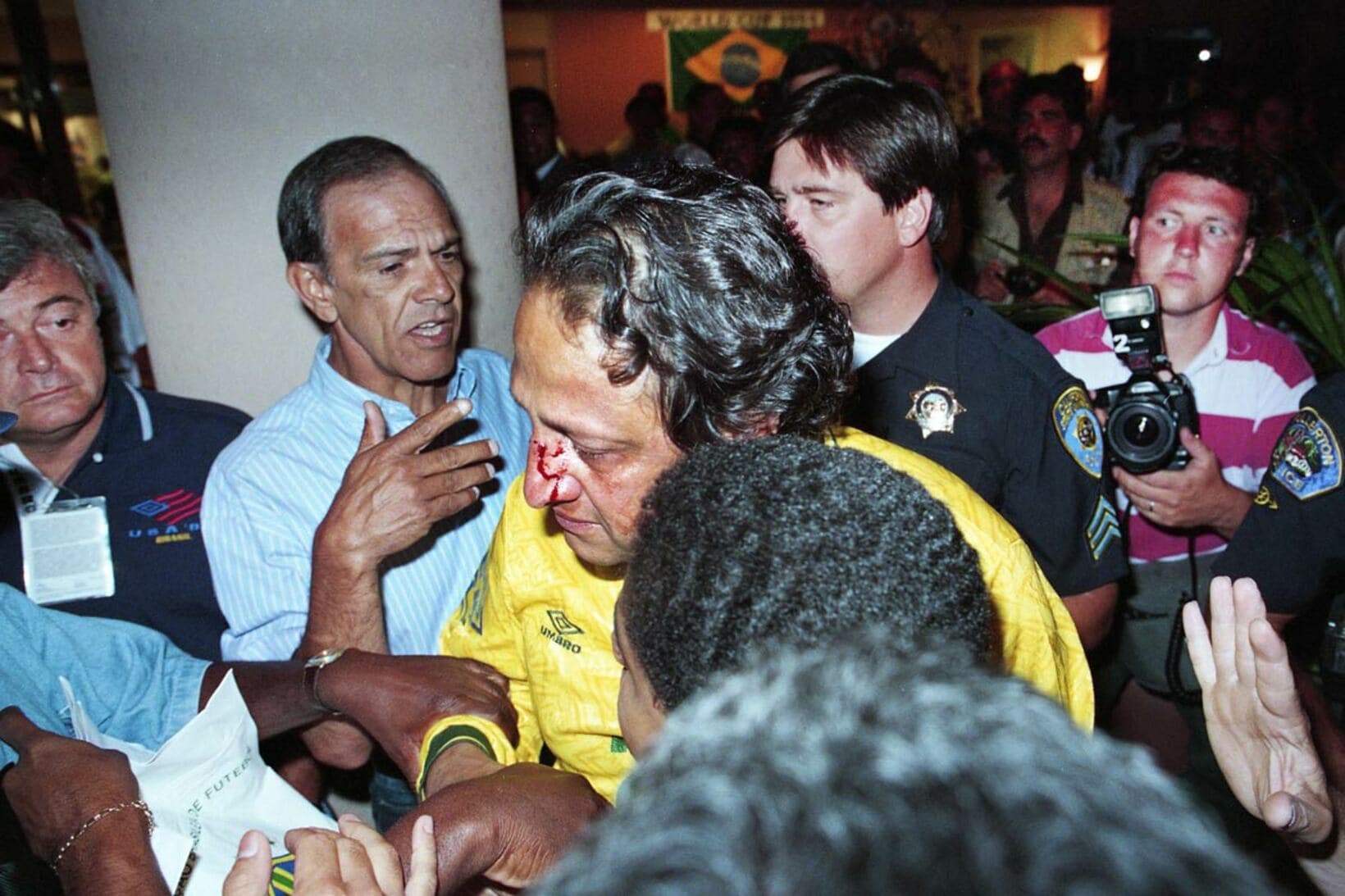 ブラジル代表の優勝祝賀会で起きたケンカで負傷した人（1994年7月17日、米ロサンゼルス）