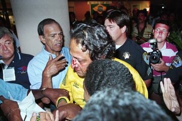 ブラジル代表の優勝祝賀会で起きたケンカで負傷した人（1994年7月17日、米ロサンゼルス）