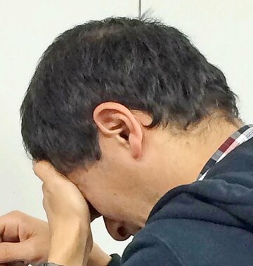 めまいが起きるメニエール病（写真はイメージです）