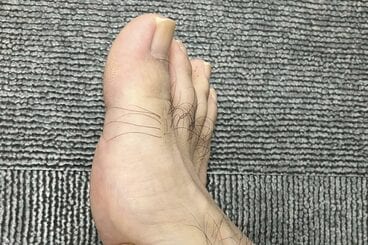 就寝中に足がつらないようにするには