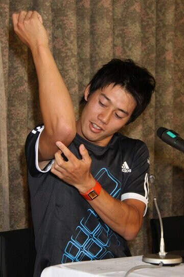 疲労骨折した右ひじを見せる錦織圭(2009年）