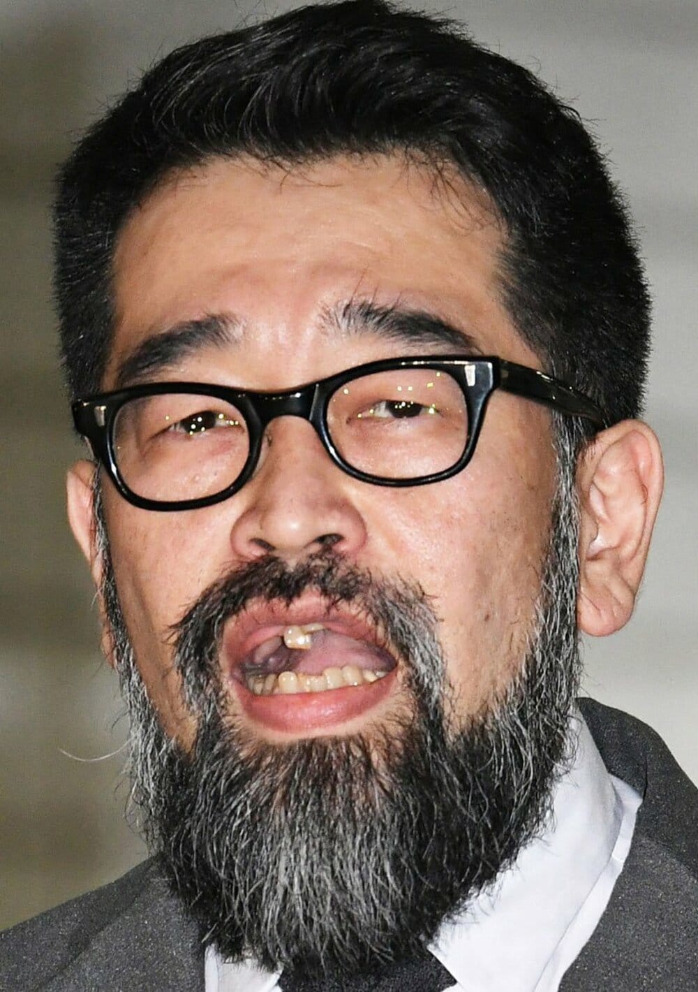 保釈の際、歯が話題になった槇原敬之