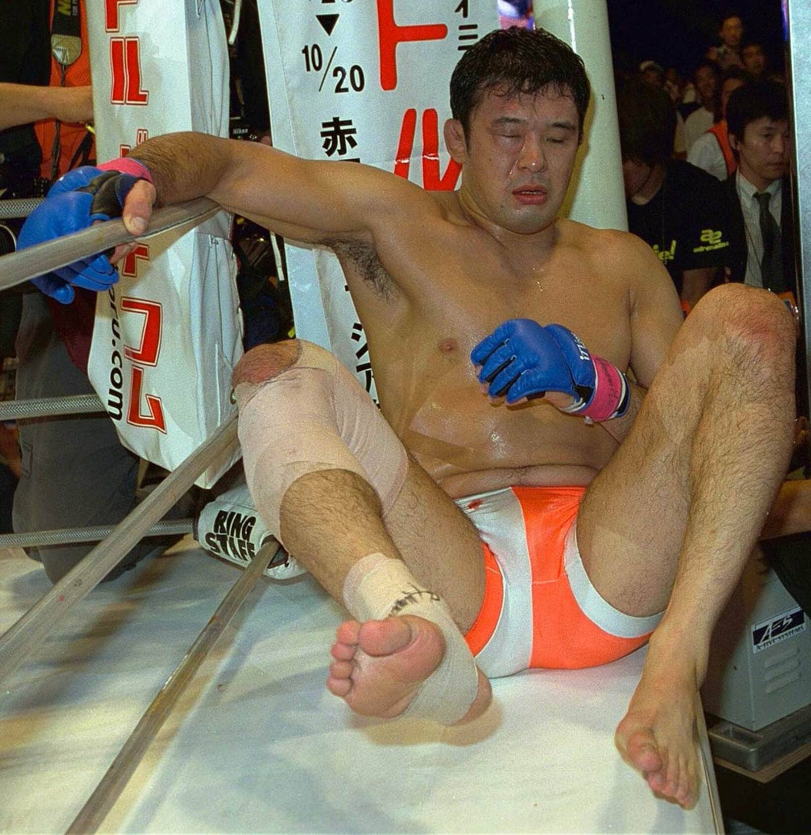 足が当たった右目は大きく腫れ上がった